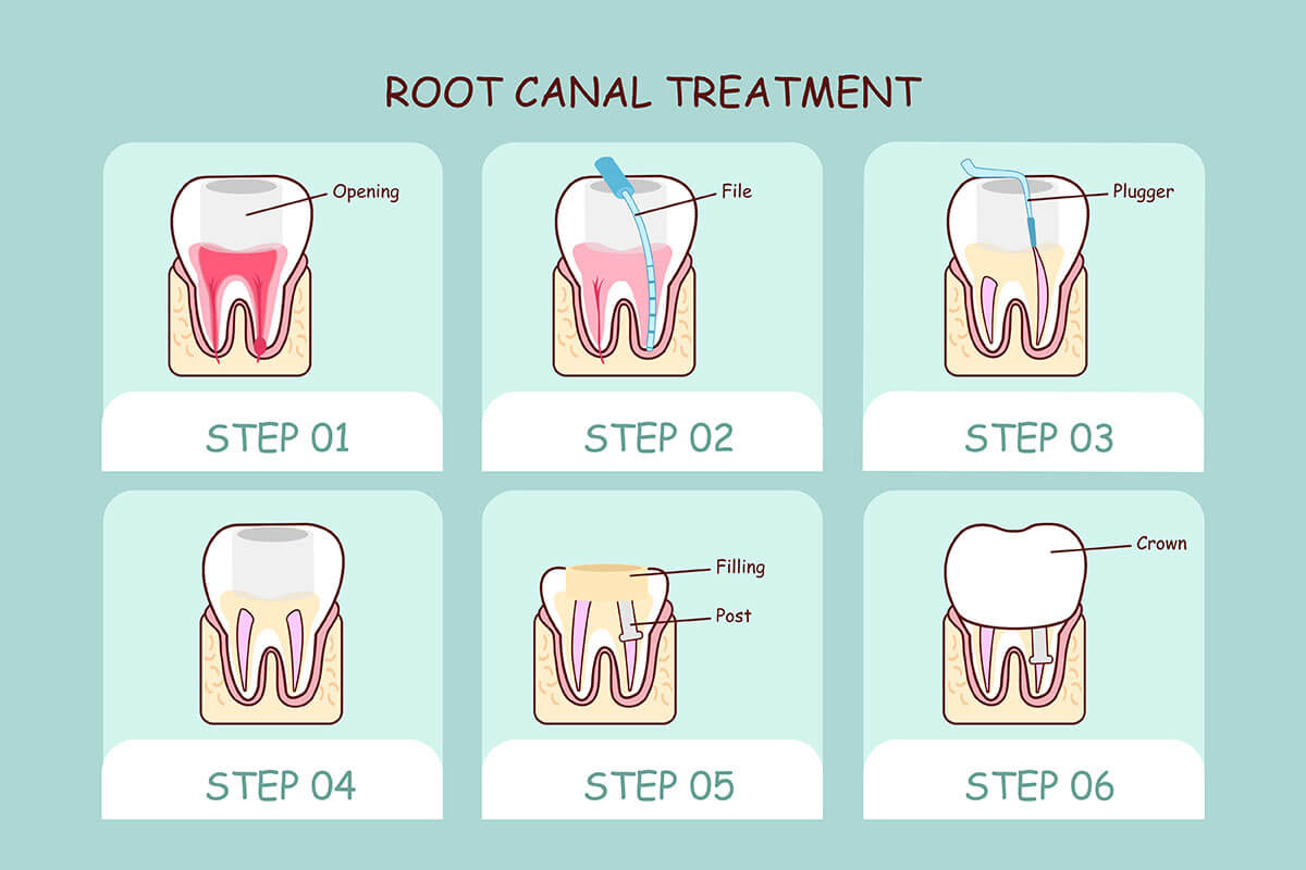 Winnie TX Dentistry