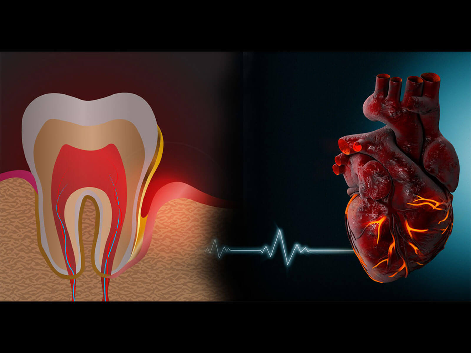 How To Take Care of Your New Dental Crowns?