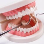 How Important Are Natural Supplements For Dental Oral Care?