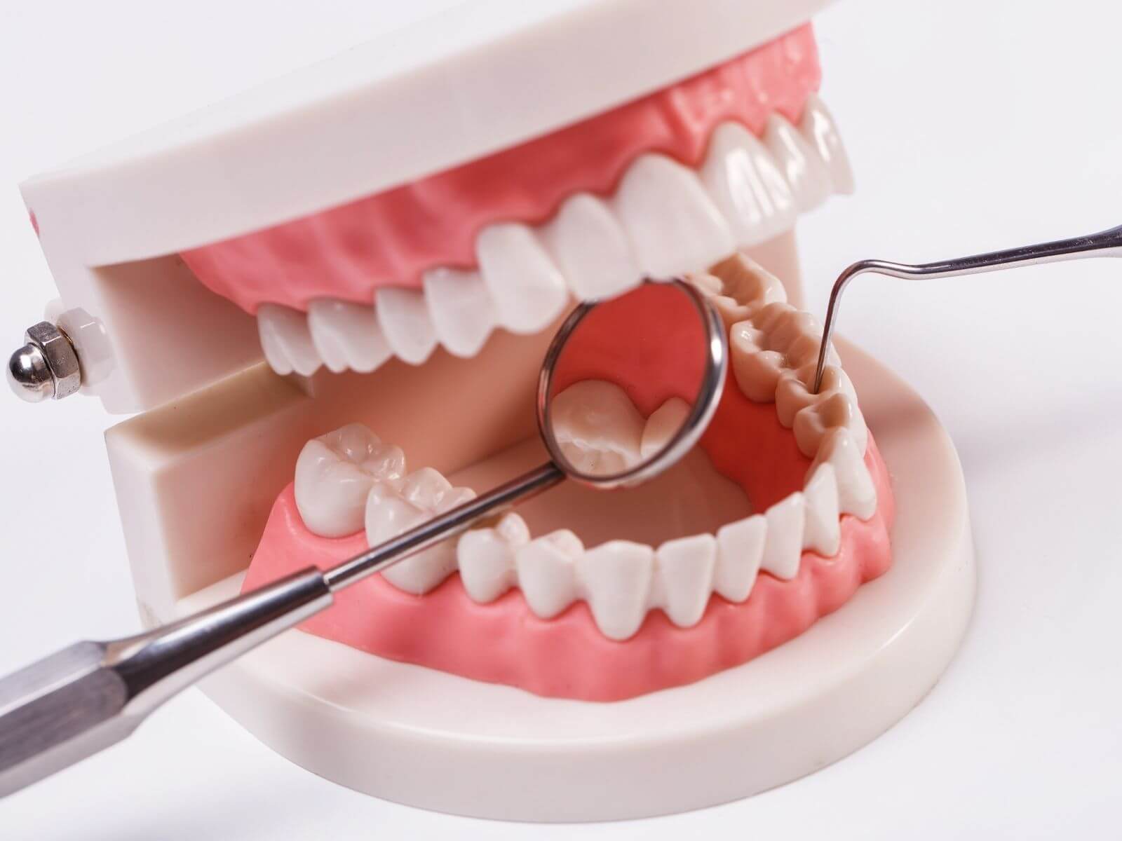 How Important Are Natural Supplements For Dental Oral Care?