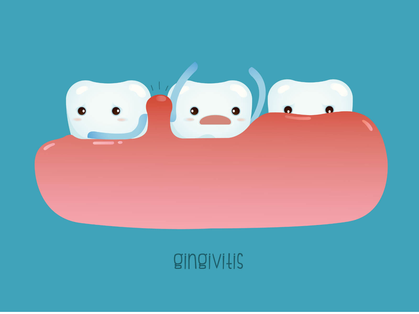 Gum Health 101: Preventing Gingivitis And Periodontitis