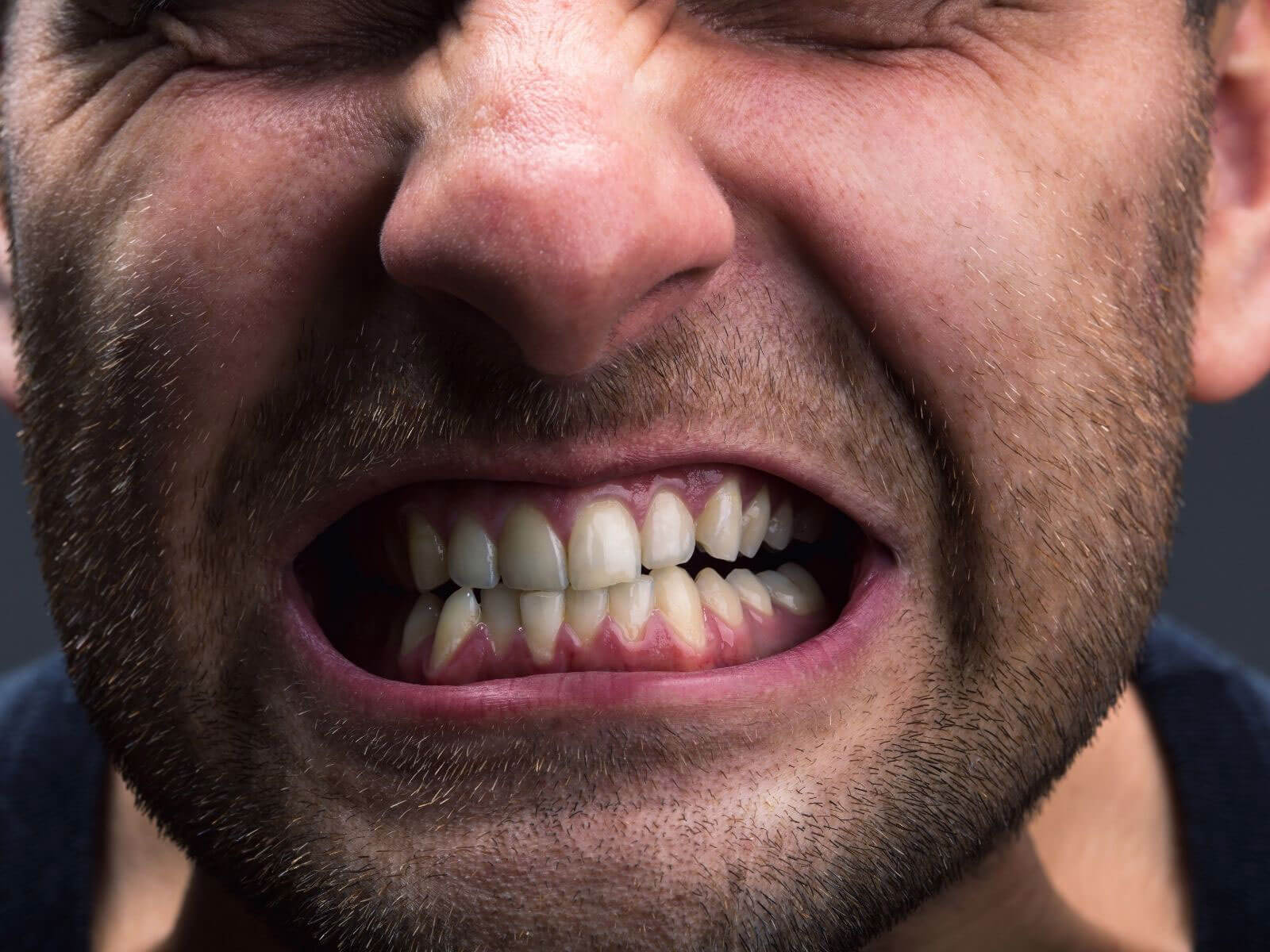 The Importance of Night Guards for Teeth Grinding
