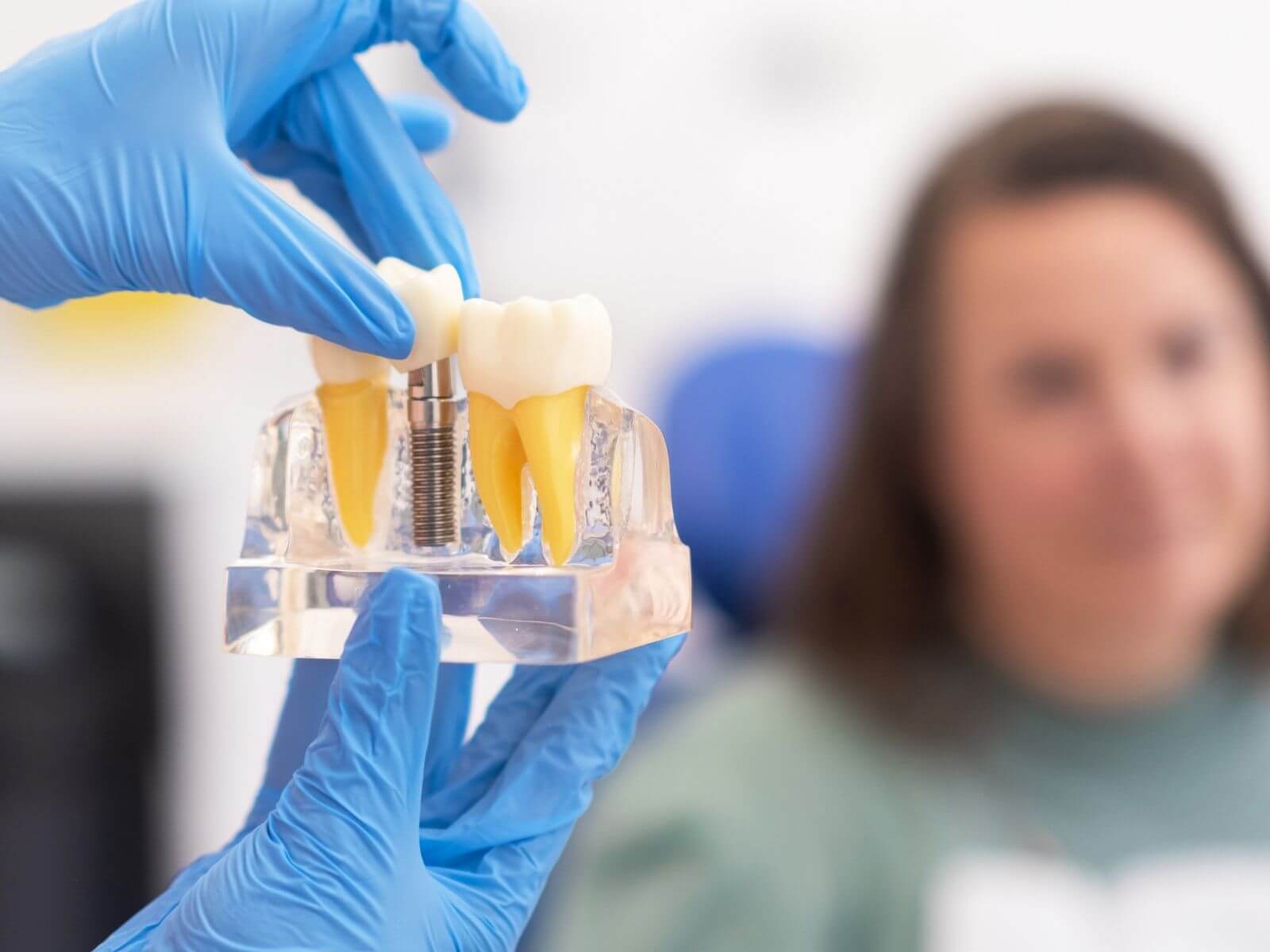 What Are Screwless Dental Implants and Are They Better?