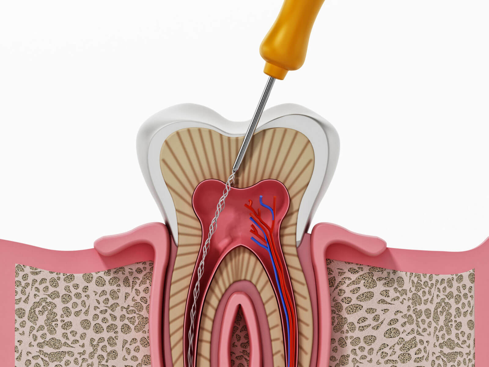 10 Signs You Might Need a Root Canal