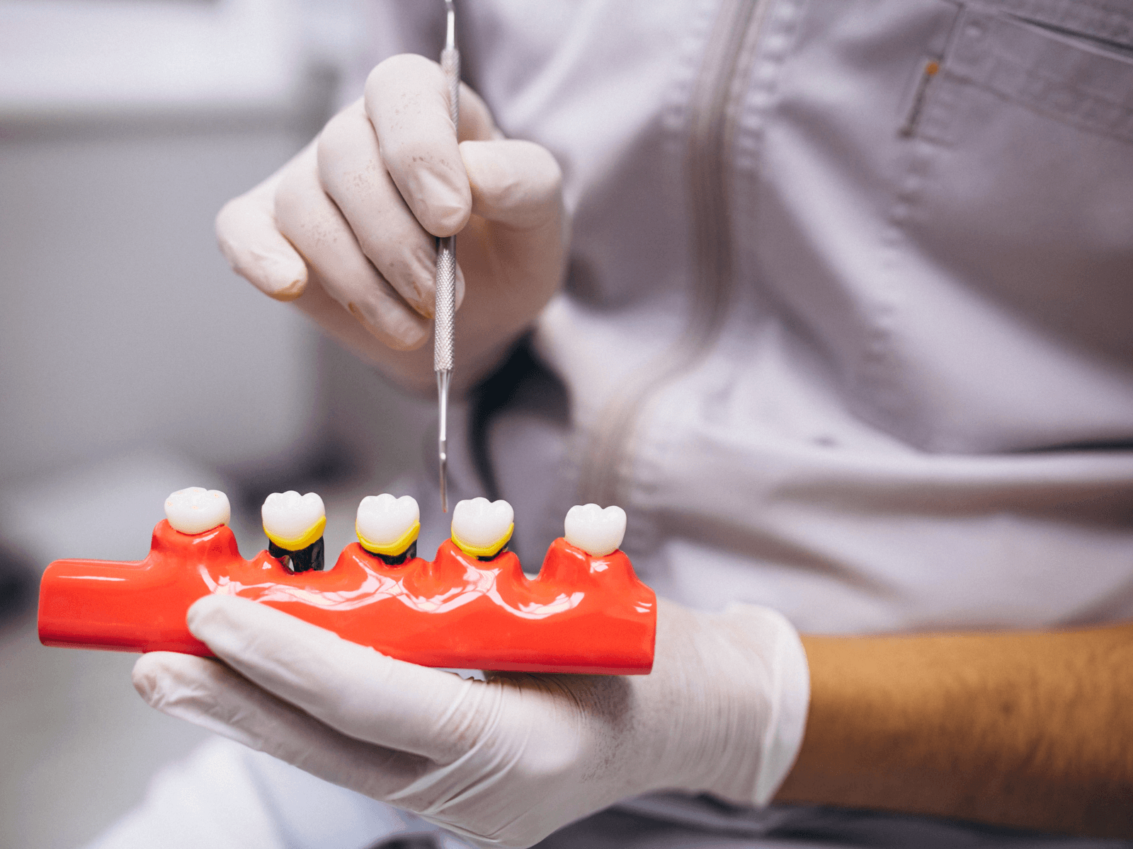 6 Types of Dental Crowns: Materials, Costs, and Which Is Best for You